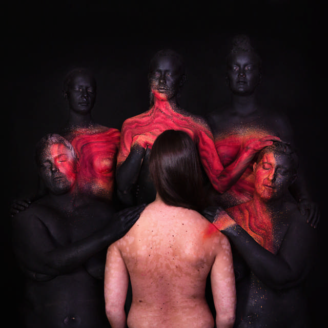 Bilde av en kvinne med ryggen til. Ryggen er bar med synlig psoriasisutslett. Rundt henne står 5 personer som er dekket i sort malin, men påført flamme som brenner. Flammen går fra den bare høyre skulder , ut gjennom en malt hånd og former en slags flamme